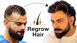 Regrow Your Hair in 29 Days! Stop Hair Fall (Secret)