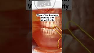 3D Dental Data in Virtual Reality