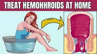 6 Natural Ways To Treat Hemorrhoids Quickly And Effectively |Treat Hemorrhoids At Home |Home Remedy