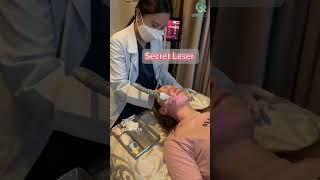 Secret Laser and Facial Filler at Girin Plastic Surgery Korea