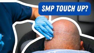 Scalp Micropigmentation Touch-up : How often do you need them?