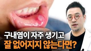 구내염이 자주 생기거나 잘 낫지 않는다면 자가면역질환일 수 있습니다