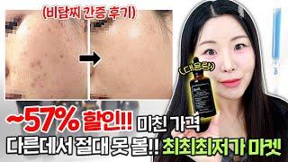 ㅎㅏ..블루드롭 대용량 마켓 드디어 왔다대체불가 트러블+붉은기 치트키어디서도 절대 볼 수 없는 최최최저가 마켓 OPEN