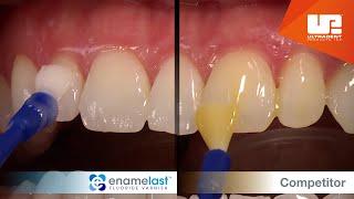 Enamelast™ fluoride varnish vs Competitor varnish