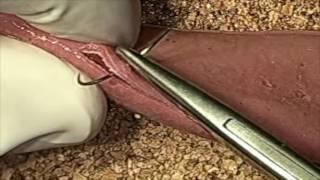 Intestinal Enterotomy (Veterinary) Synthetic tissue: Dr. Jeffrey J Runge DVM, DACVS