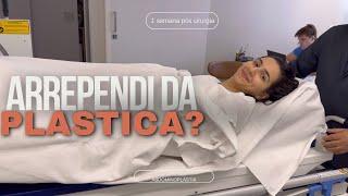 Tudo sobre minha cirurgia plástica