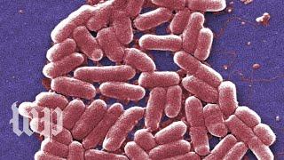 E. coli infections are gross. Here are 5 facts you can't unlearn about them.