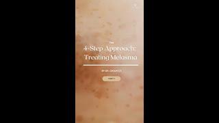 The 4-Step Approach to Treating Melasma | Ensoul Medical Clinic