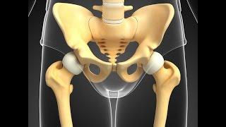 The Wise Anderson Protocol and Pelvic Pain Part A- Prostatitis Misdiagnosis