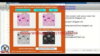 Leukemia Blood Cancer Detection Using Image Processing | With Source Code | Matlab Project Leukemia