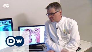 Diagnosing tuberculosis | In Good Shape