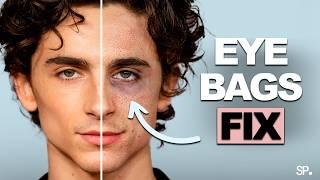 Remove Eye Bags Forever! (Science Based)