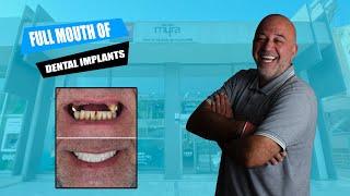 The journey to a new smile: A patient's experience with dental implants  | Interview for new teeth