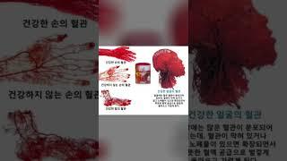 간?간에쨩  예뻐지고 좋아지는  독일피엠-Imm가서 차량보너스받기 난초 010  9944  0036