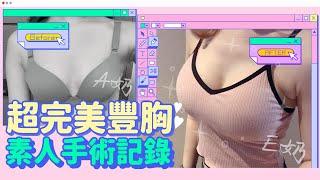 超完美豐胸⭐ 素人手術記錄 ｜韩国必妩整形医院View Plastic Surgery