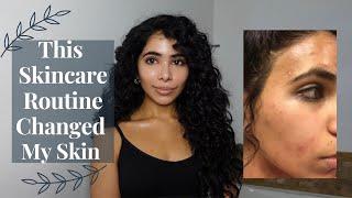 My Late 20s Anti-Aging Tretinoin Skincare Routine | Combo Acne Prone Skin