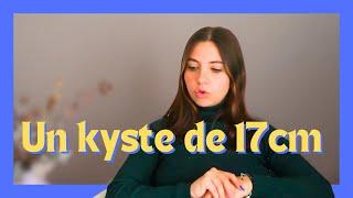 Je me suis faite opérer | KYSTE OVARIEN 