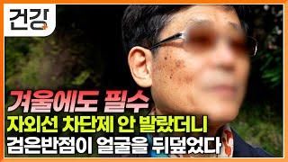 검버섯인 줄 알고 그냥 방치했는데 돌이킬 수 없는 병이 됐다?｜자외선 차단제 바르지 않고 다니는 사람에게 나타나는 공통적인 증상｜올바른 피부 관리법｜명의｜#EBS건강