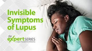 The Expert Series S6E1: Invisible Symptoms of Lupus