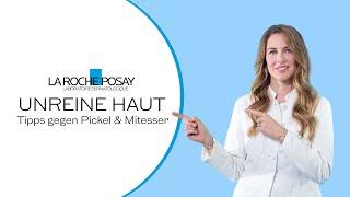 Unreine Haut? Tipps gegen Pickel und Mitesser | La Roche Posay