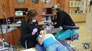 White Laser Fillings -  Emma