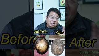 Suresh Shakya, our satisfied customer, expressed his emotions.l | Yachu Hair Oil