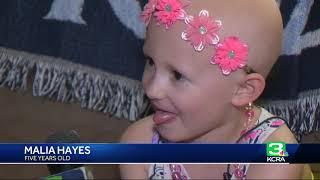 Citrus Heights father shows solidarity with bald daughter