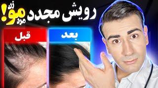 درمان خانگی و قطعی ریزش مو و رویش مجدد موهای ریخته شده در مردان و زنان!