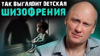 ПЕРВЫЕ признаки детской шизофрении! / Как ПРЕДОТВРАТИТЬ серьезные последствия?