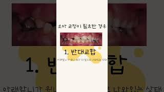 소아교정은 언제부터 가능할까? 소아교정이 필요한 경우와 시기 #치아교정전문의 #평택 #치아교정 #어린이교정 #소아교정 #소아교정시기