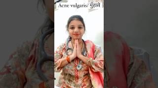 Acne vulgaris/ मुँहासे (HINDI) #pimple #homoeopathy #acne #acnetreatment #medicine