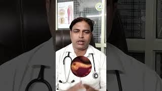 Chronic Pancreatitis की Problem कैसे ठीक होगी ? | Ashiyana HealthCare | Dr. Deepak Kumar