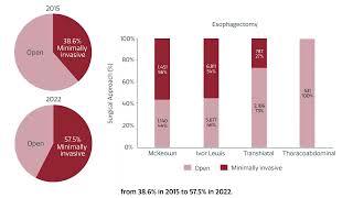 Risk Calculator for Esophagectomy