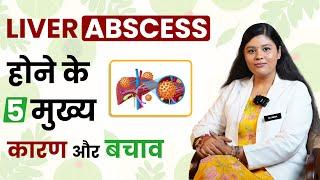 क्या Liver Abscess लिवर ख़राब कर सकता हैं ? | Causes & Treatment of Liver Abscess | SRIAAS