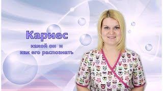 Кариес – какой он и как его распознать? Рассказывает стоматолог | Стоматология Самара влог