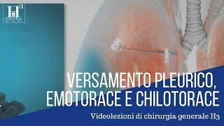 Versamento pleurico, emotorace, chilotorace