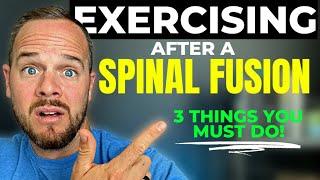 Can I Lift Weights After Spinal Fusion Surgery?: 3 MUST FOLLOW RULES