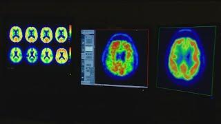 FDA approves new Alzheimer’s treatment