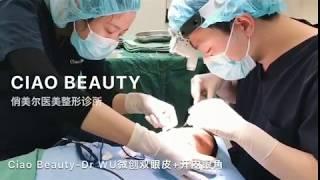 Ciao Beauty-Dr William WU微创三点式双眼皮+内眼角手术