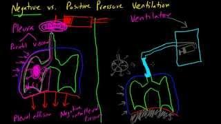 Negative vs. Positive Pressure Ventilation