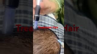 hair fall treatment