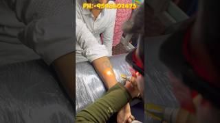 Tattoo Removal #viral #trending #tattoo #remove a1 Tattoo