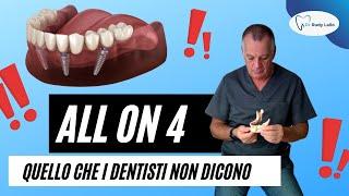 All on Four: quello che i Dentisti Non Dicono.