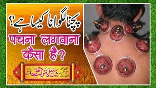 Pachna (Hijama) Lagwana Kaesa Hai | पचना लगवाना कैसा है | پچنا لگوانا کیسا ہے