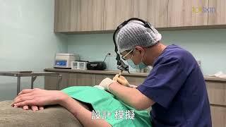 多點固定綁辮式雙眼皮技術介紹：101skin晶漾診所楊弘旭醫師