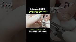 걸을때마다 욱씬욱씬 아프셨다고ㅠㅠ 검지발톱 말끔히 관리^^ #레푸스 #일산레푸스 #내성발톱 #무좀발톱 #ingrown_toenail #일산내성발톱 #일산무좀발톱 #발톱