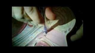 MNF Medad Team | Dr. Ayman Abdallah H&N Practical Anatomy [ Plastic ]