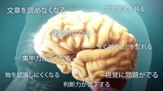 アルツハイマー病を理解する (Understanding Alzheimer’s Disease (AD))