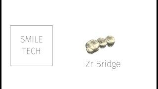 3shape Zirconium Bridge Design.