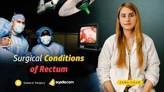 Exploring Surgical Conditions of Rectum and its Anatomy and Blood Supply | TRAILER